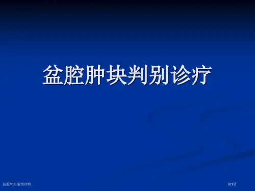 盆腔肿块鉴别诊断