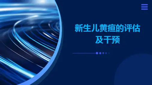 新生儿黄疸的评估及干预PPT课件