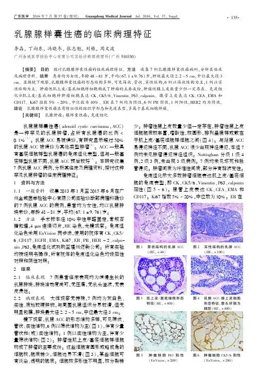 乳腺腺样囊性癌的临床病理特征