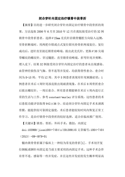 闭合穿针内固定治疗锁骨中段骨折