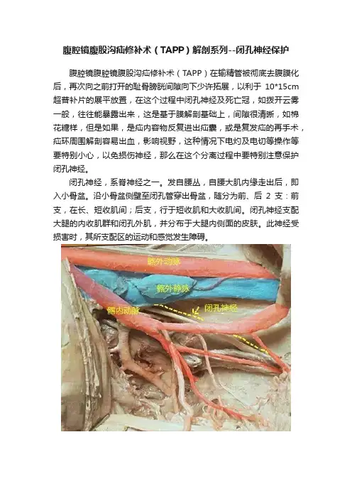 腹腔镜腹股沟疝修补术（TAPP）解剖系列--闭孔神经保护