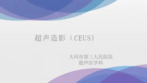 超声造影
