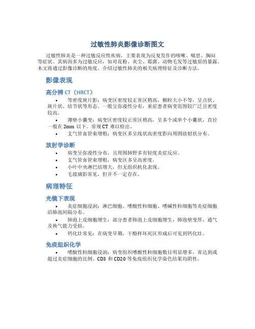 过敏性肺炎影像诊断图文