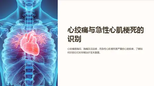 心绞痛与急性心肌梗死的识别