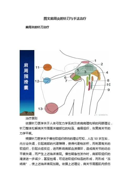 图文肩周炎的针刀与手法治疗