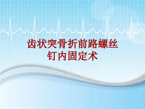 手术讲解模板：齿状突骨折前路螺丝钉内固定术