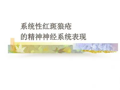 系统性红斑狼疮脑病PPT课件