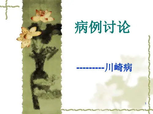 川崎病病案分析