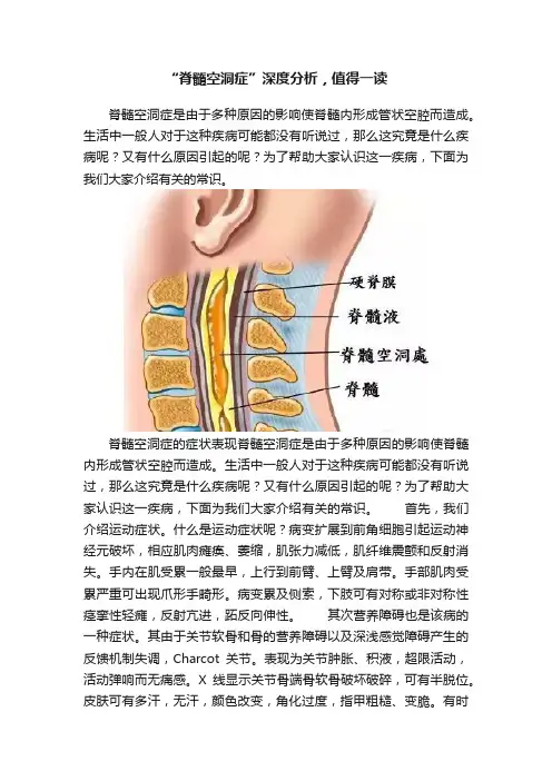“脊髓空洞症”深度分析，值得一读