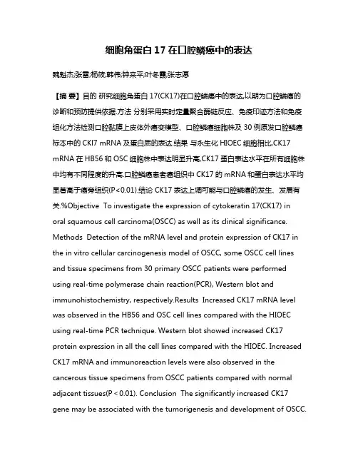 细胞角蛋白17在口腔鳞癌中的表达