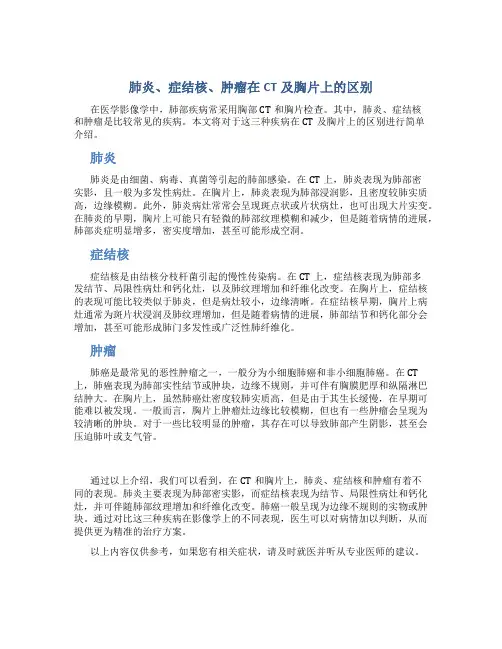 肺炎症结核肿瘤在CT及胸片上的区别图文