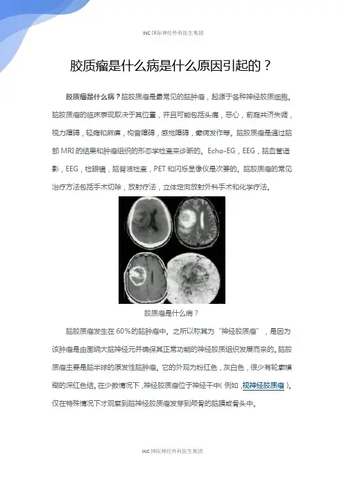 胶质瘤是什么病是什么原因引起的？