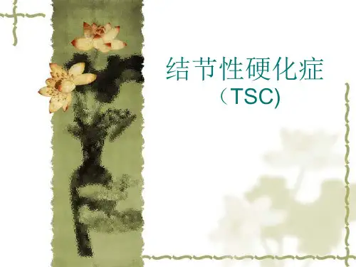 结节性硬化症资料