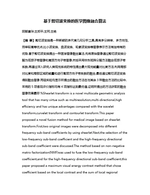 基于剪切波变换的医学图像融合算法