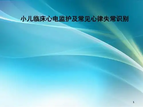 小儿临床心电监护及常见心律失常的识别 ppt课件