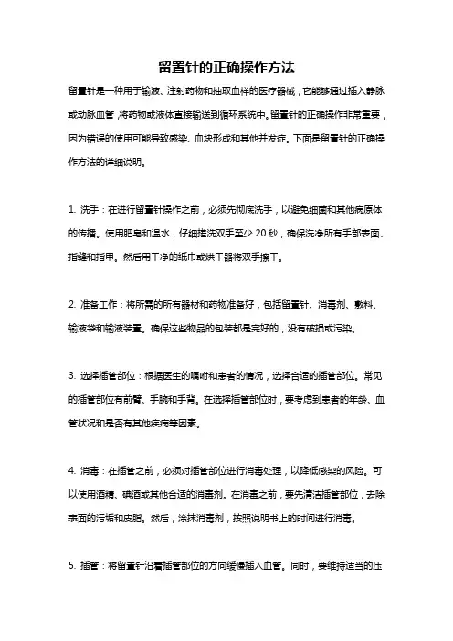 留置针的正确操作方法