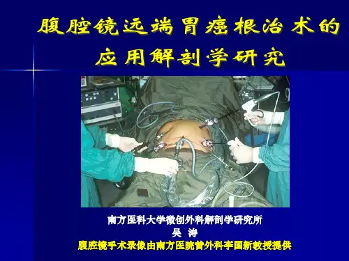 腹腔镜下远端胃癌根治术课件.