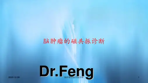 脑肿瘤的磁共振诊断(PPT课件)