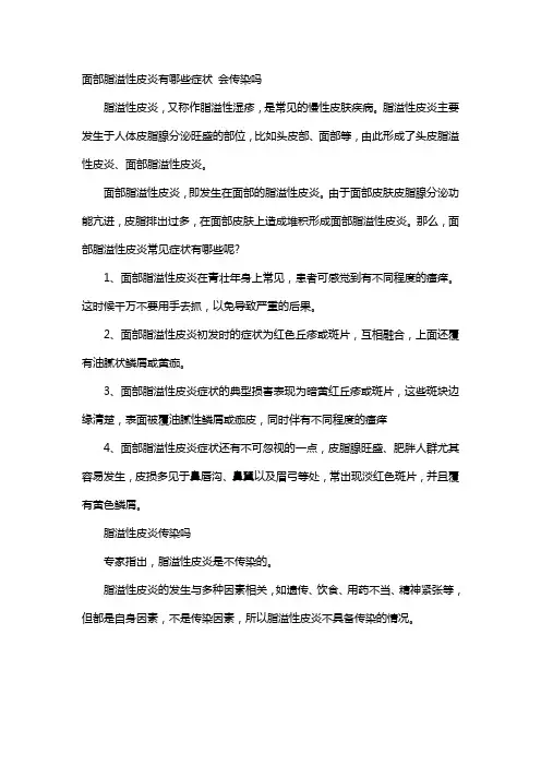 面部脂溢性皮炎有哪些症状 会传染吗