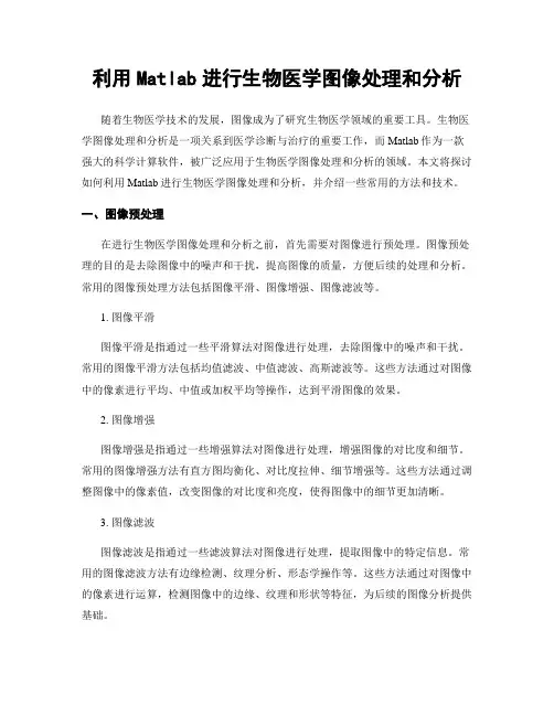 利用Matlab进行生物医学图像处理和分析