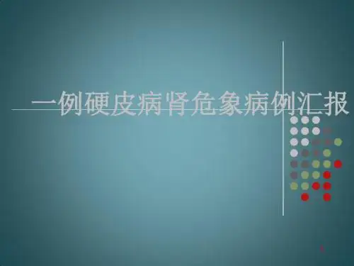 硬皮病病例汇报ppt课件