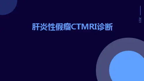 肝炎性假瘤CTMRI诊断