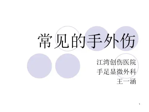常见的手外伤ppt课件