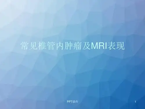 常见椎管内肿瘤及MRI表现  ppt课件