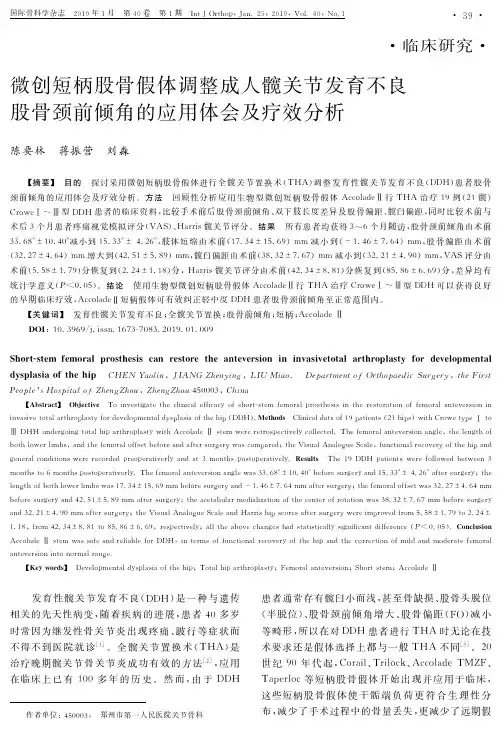 微创短柄股骨假体调整成人髋关节发育不良股骨颈前倾角的应用体会及疗效分析