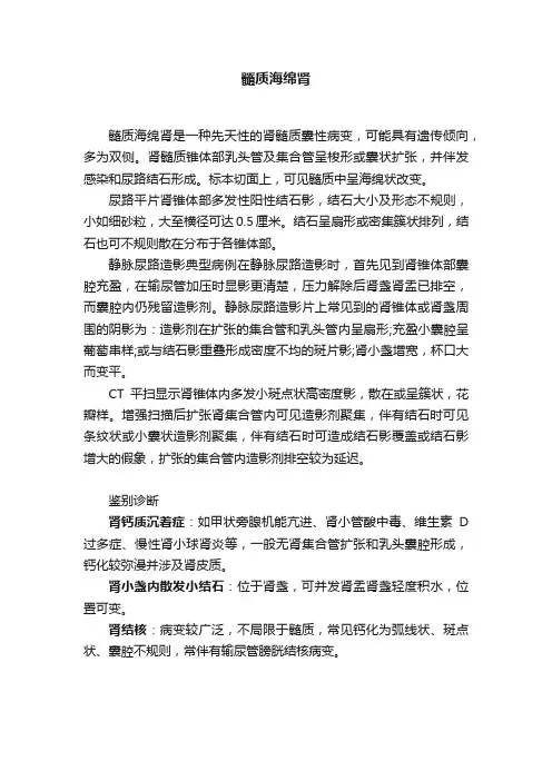 髓质海绵肾