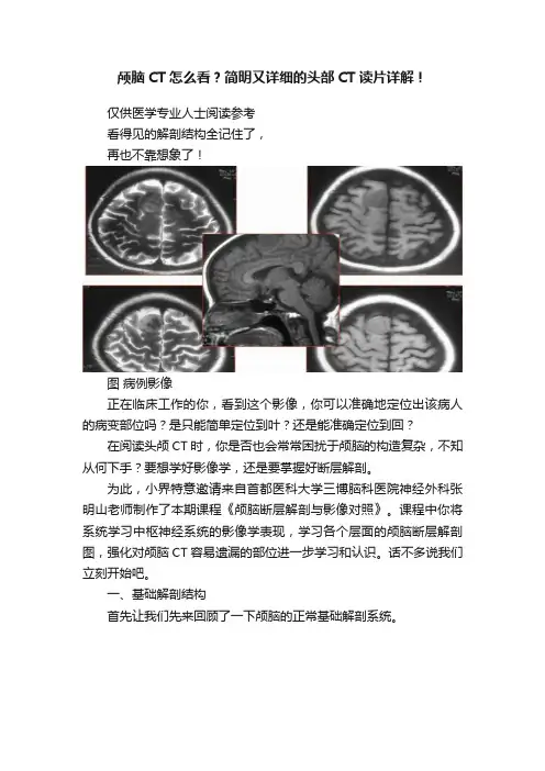 颅脑CT怎么看？简明又详细的头部CT读片详解！