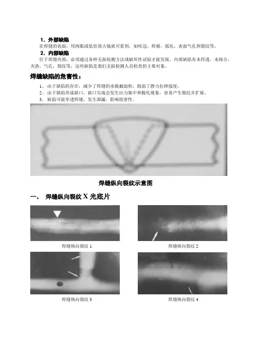 射线检测-焊缝缺陷图谱