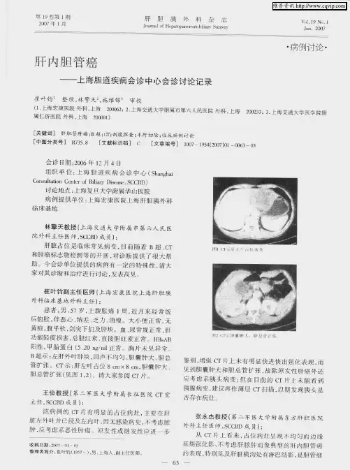 肝内胆管癌——上海胆道疾病会诊中心会诊讨论记录