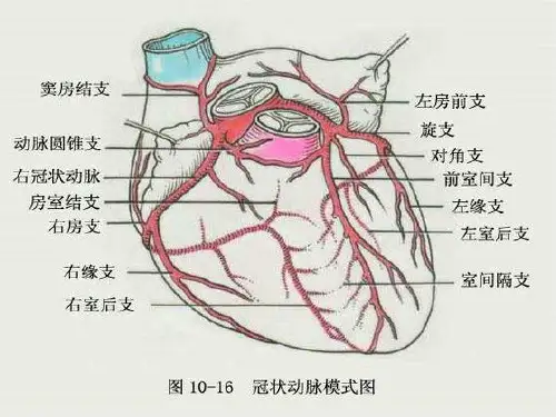 冠脉造影和支架置入术课件