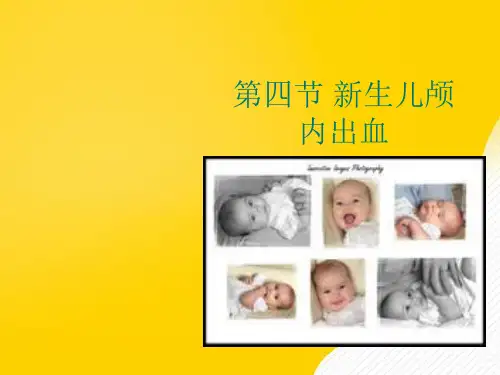第四节新生儿颅内出血优秀PPT资料