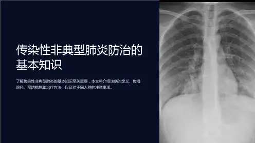 传染性非典型肺炎防治的基本知识