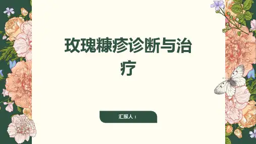 玫瑰糠疹诊断与治疗PPT