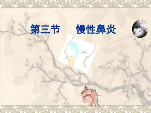 慢性鼻炎ppt课件
