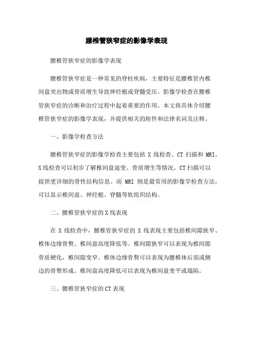 腰椎管狭窄症的影像学表现