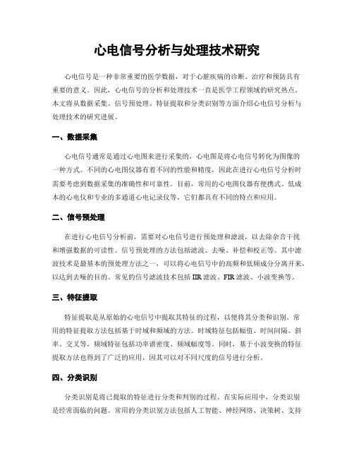 心电信号分析与处理技术研究