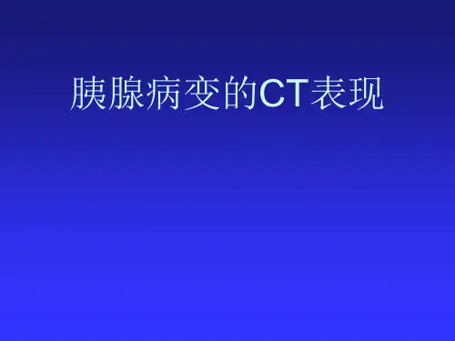 胰腺病变的CT表现