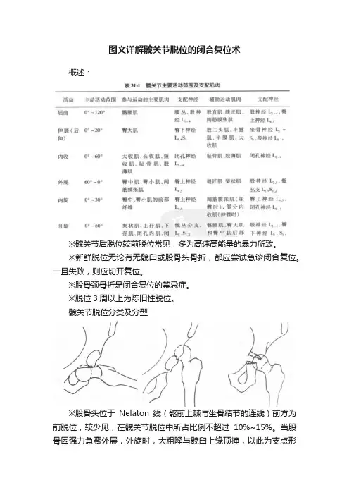 图文详解髋关节脱位的闭合复位术