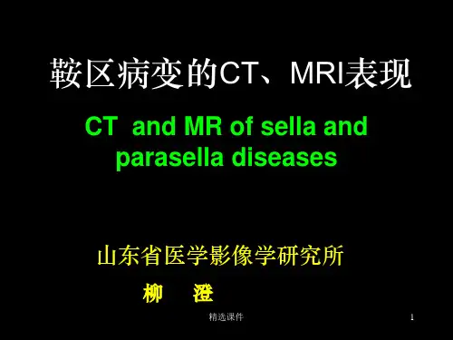 鞍区解剖-断层影像解剖ppt课件