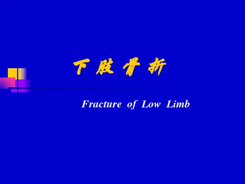 下肢骨折牵引图PPT课件