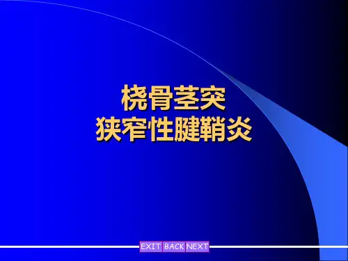 桡骨茎突狭窄性腱鞘炎