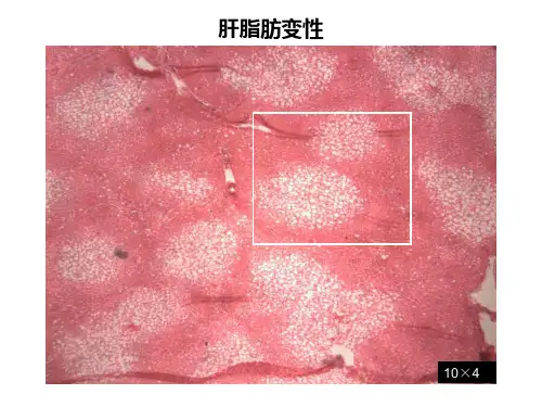 病理学切片标本图