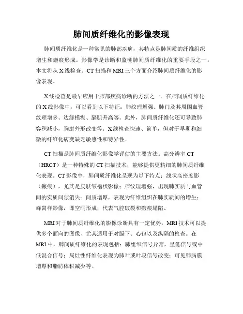 肺间质纤维化的影像表现