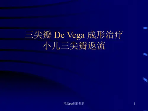 三尖瓣-De-Vega-成形治疗小儿三尖瓣返流PPT课件