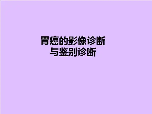 胃癌的影像诊断与鉴别诊断
