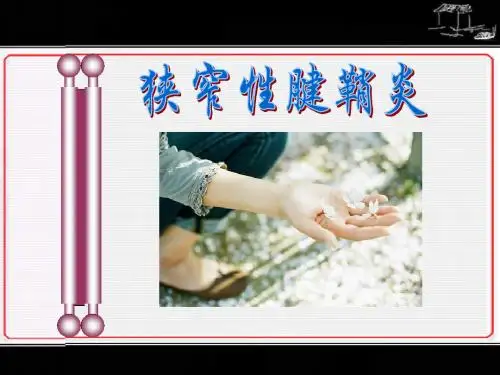 狭窄性腱鞘炎